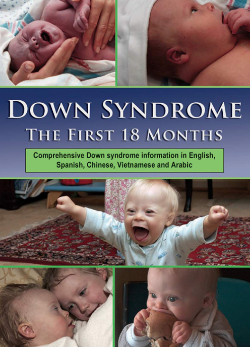 Cover of Down Syndrome the first 18 months