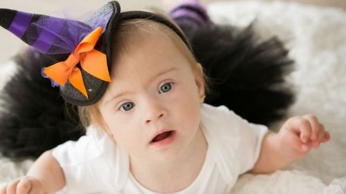 a photo of a baby wiht down syndrome dressed up as a witch
